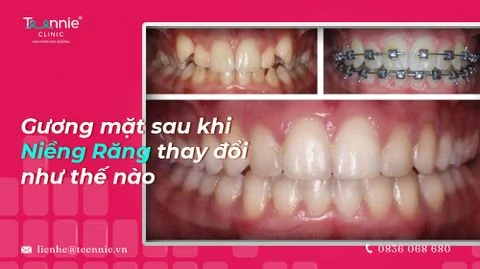 guong mat sau nieng rang thay doi nhu the nao bia c86b703515e74bdda76e9a42c1c6d7c8 large