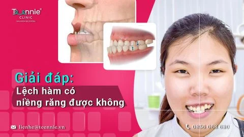 lech ham co nieng duoc khong bia 1dbb49697a15467a81869657a31e823f large