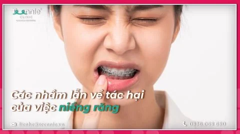 nham lan ve tac hai cua viec nieng rang bia 08c24b9fb92746c1953ee16f515859f1 large