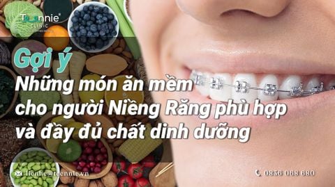 nhung mon an mem cho nguoi nieng rang bia 215ac9add851463c9c4f1920a604bd71 large