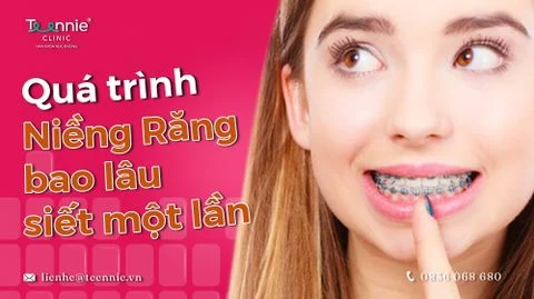 nieng rang bao lau siet mot lan bia 91d71ce6ffaf4fb6a1dd307e29fc4de1 large