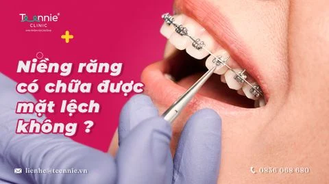 nieng rang co chua duoc mat lech bia b3990b93b06449c9af3e0f9cd88410bf large