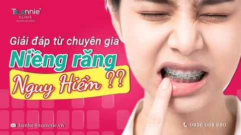 nieng rang co nguy hiem khong bia 3c768859e3504a4580805c396546953b large