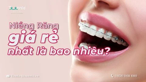 nieng rang re nhat la bao nhieu bia 218a7ddbe40b40b89ec59dfaadfd4b02 large