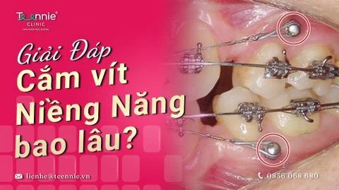 thoi gian cam vit nieng rang bao lau bia b89ca2c47a6642a4a7f48c4d0d0e6f57 large