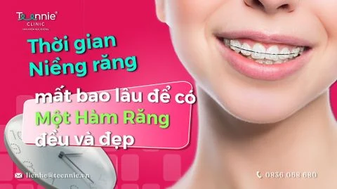thoi gian nieng rang mat bao lau bia 04774cb1fb744282b16454abe759e56b large