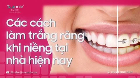 cach lam trang rang khi nieng bia 7bd9613d7c694b0ba185dd81e3d3126a large