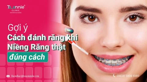 goi ich cach rang khi nieng rang bia 3360ae16414f4dba8f364e324febf416 large