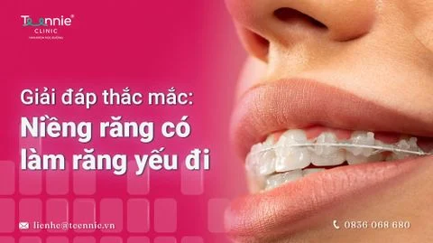 nieng rang co lam rang yeu di hay khong 5354aa93d99c437b90424bfb880f8fea large