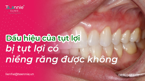 bi tut loi co nieng rang duoc khong bia bf72a68fbd964c88ad45a3e58d888b08 large