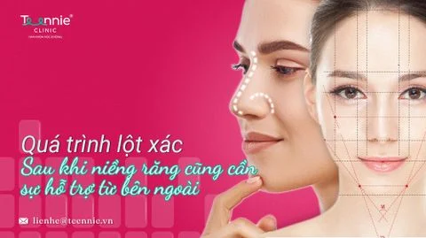 lot xac sau khi nieng rang bia 2e9f1cc48681459b8a6c75831e0d9613 large