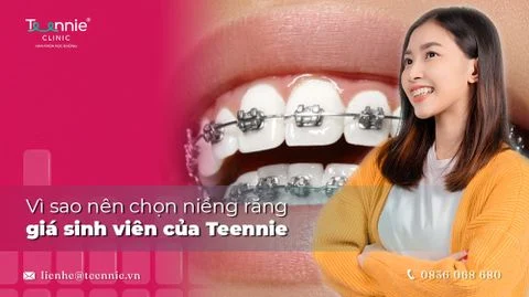 nieng rang gia sinh vien tai teennie bia 914274dbc2ae45a197052619ad81d43f large