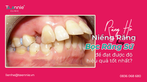 rang ho nen nieng hay boc su bia 6c14273b90614c70b5a73aacc3b71bd8 large 1
