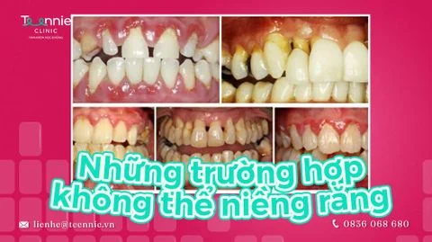 teenie nieng rang nieng rang tham my bia 9ef55e8fe85a40039cb420a54ccb2ca7 large