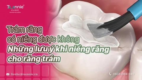 tram rang co nieng duoc khong bia 37170b3c4bd1491f829ddd6b38dc3e99 large