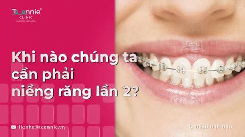 khi nao chung ta can nieng rang lan 2 bia 855c6857656149de8e724a7d48a4cfbf large