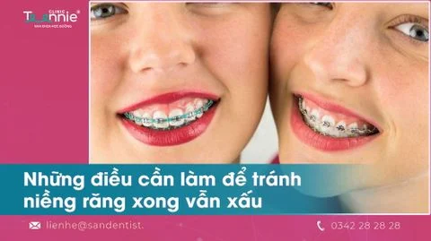 nieng rang xong van xau bia f0ce799e1b0942288866d7414364fc81 large