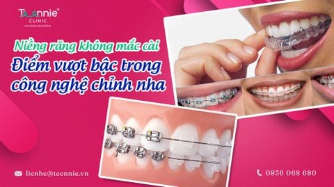 nieng rang khong mac cai diem vuot bac trong cong nghe chinh nha 9fa75261194d4456af0a80b2fc995019 large