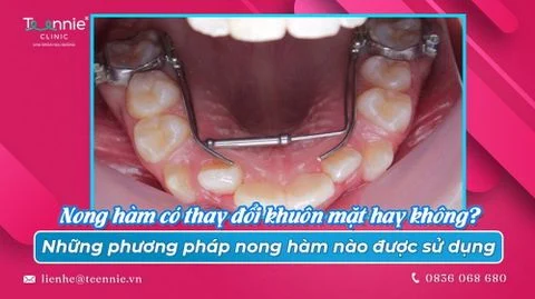 ay doi khuon mat hay khong nhung phuong phap nong ham nao duoc su dung 8dbb88b246674305b5ce841116bebf7c large