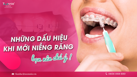 nhung dau hieu khi moi nieng rang ban nen chu y d69a882d5388428985d9b905312adfd3 large