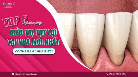 cac phuong phap dieu tri tut loi tai nha moi nhat co the ban chua biet 2784eea79ff340fc8f47eaafd3e0fade large