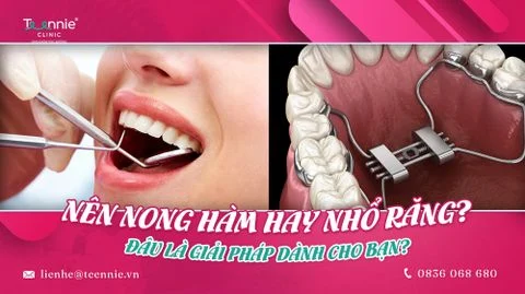 nen nong ham hay nho rang dau la giai phap danh cho ban b356cc2c267c4bd8a9e2393aede1592c large