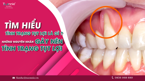 tinh trang tut loi la gi nhung nguyen nhan gay len tinh trang tut loi 232efea7f4754f93a37a46a594bb6b8e large