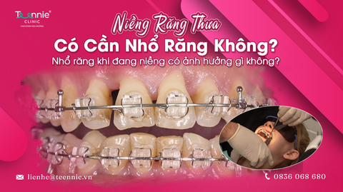 ua co can nho rang khong nho rang khi dang nieng co anh huong gi khong 99419ab4b45646c5bbf6d063b541e203 large