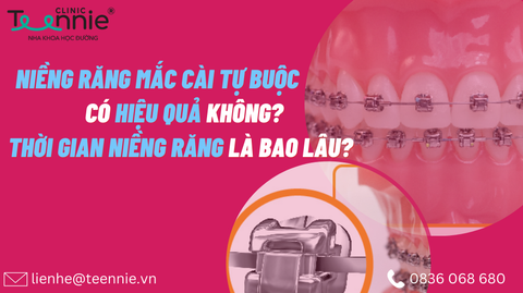 nieng rang mac cai kim loai tu buoc fe2185557fef4f2b92ae0885c0b46c7c large