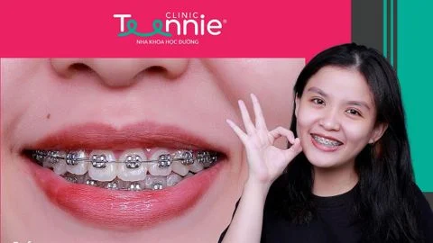 9 loai thuc pham khong nen an khi nieng rang 01 fbe27605846b4c11a1260e0876676cdf large