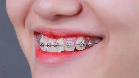 nieng rang mot ham duoc khong 03 5ccc631a5fd3404ead25233ed0042057 large
