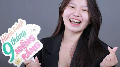 Đeo niềng răng trong bao lâu thì tháo được?