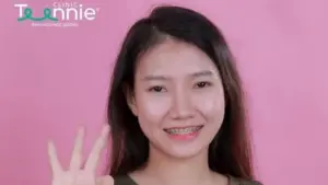 Mới niềng răng nên kiêng những loại thực phẩm nào?