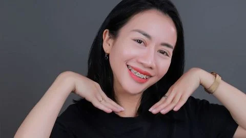 Răng hô có phải do di truyền không?