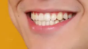 4 loại rau củ chỉ 5k nhưng làm trắng răng tuyệt vời