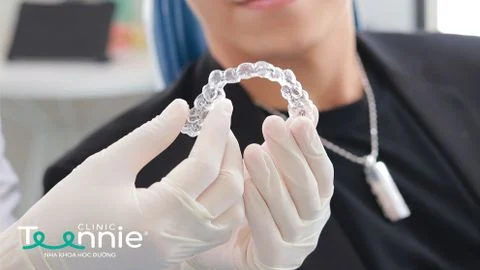 Ai có thể dùng niềng răng trong suốt invisalign?