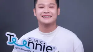 Bao nhiêu tuổi thì không nên niềng răng?
