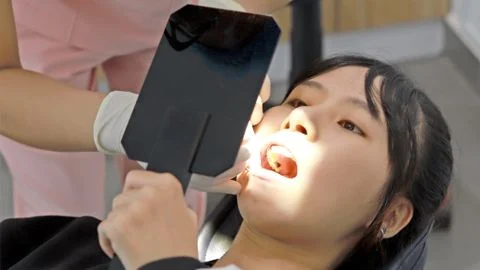 Chế độ ăn uống lành mạnh giúp giảm hôi miệng