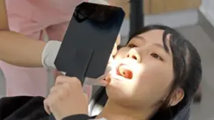 Nhổ răng sữa sớm cho trẻ, có nên hay không?