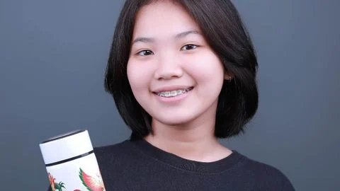 Niềng răng thay đổi khuôn mặt ra sao?