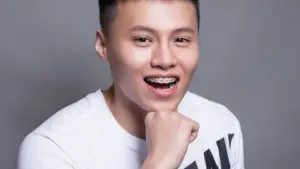 Lệch hàm gây ảnh hưởng như thế nào?