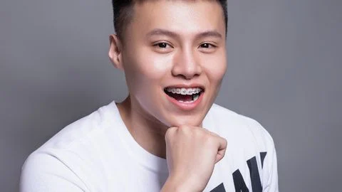 Lệch hàm gây ảnh hưởng như thế nào?