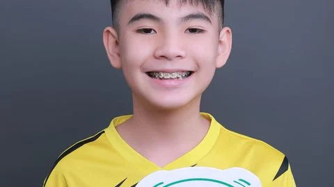 thoi diem vang de nieng rang cho tre
