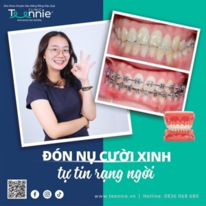 4 bệnh lý xuất hiện dấu hiệu ở răng miệng