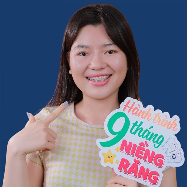 Biến chứng nguy hiểm của biện pháp rút tủy răng