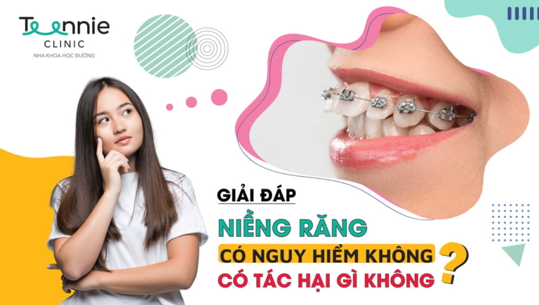 Giải đáp: Niềng răng có nguy hiểm không, có tác hại gì không?