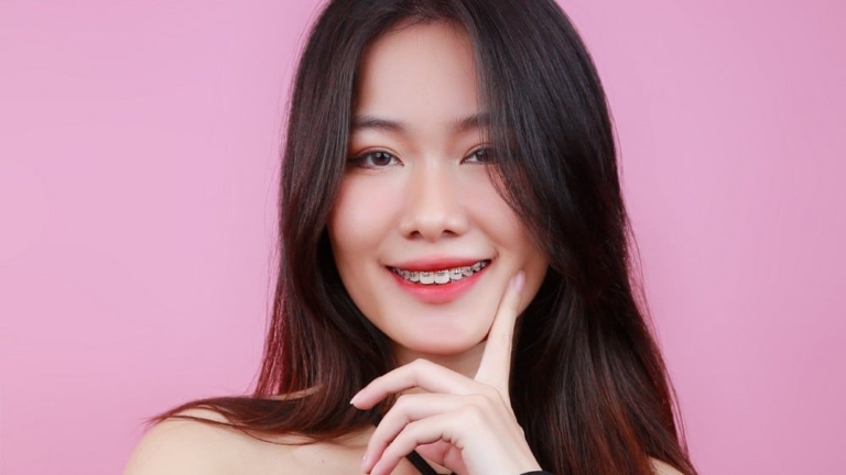 Hình dạng răng cửa nói gì về số mệnh của bạn?