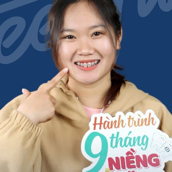 Hôi miệng cần kiêng ăn những gì?
