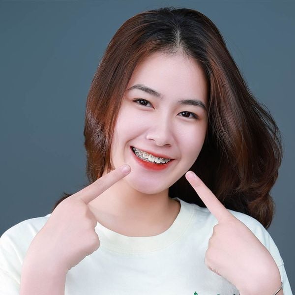 Khắc phục tình trạng hôi miệng chảy máu răng