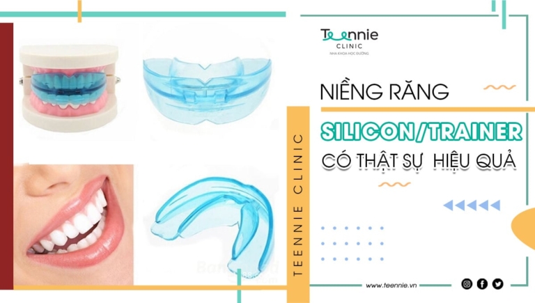 Niềng răng Silicon/Trainer có thực sự hiệu quả như bạn nghĩ?